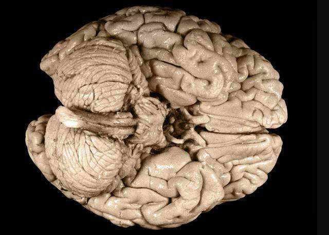 是非凡大脑让爱因斯坦成为物理学家，还是物理改变了他的大脑？