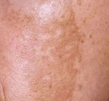 化妆都遮不住的“*褐斑黄**”？樊哥来拯救你了