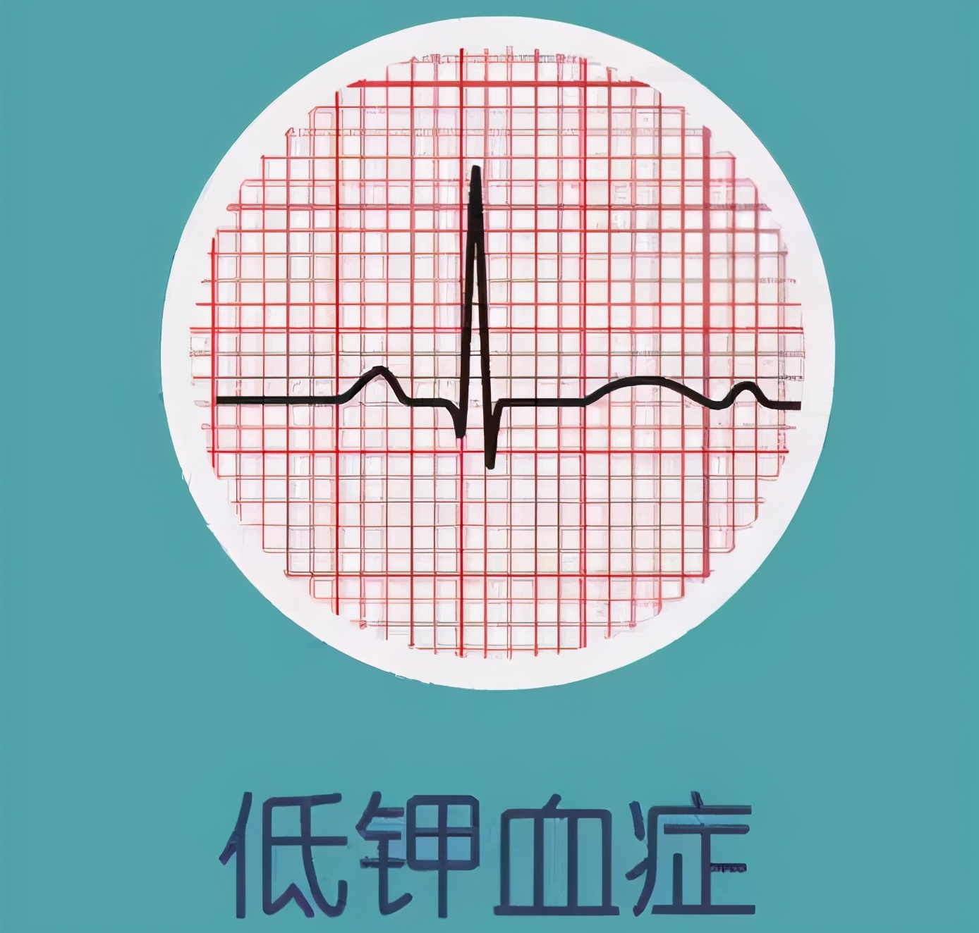 女大学生吃辣条,10岁女孩吃辣条腹痛