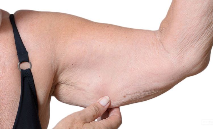 千金难买老来瘦？4个可能会引起肌少症的原因，要远离