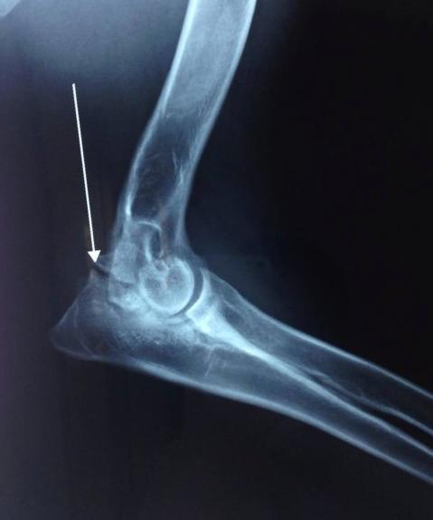 软骨病站立不起来怎么回事,小狗狗髋关节有问题不会站立