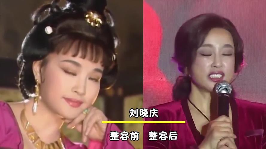 10位被整形毁掉的女星,被整容毁掉的女明星