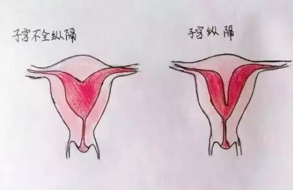 医生精美手绘图片大全,宫颈息肉红蓝铅笔手绘图