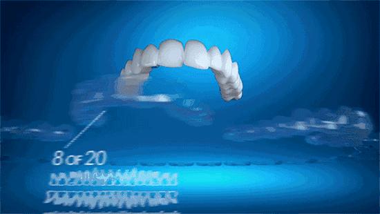 牙齿矫正你还在等什么,牙齿矫正对你最大的改变