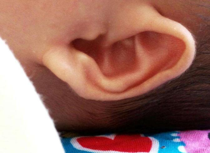 耳仓的危害,耳仓有什么危害