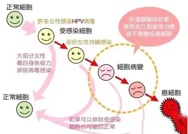 hpv报告单阳性就是宫颈癌吗,妇产科医生戴手套检查hpv