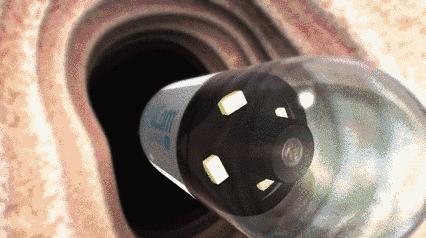 做一次胶囊内镜是什么感觉？最大的感觉就是‘没感觉’