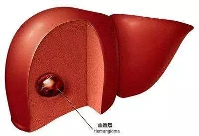 肝脏检查指标分析,肝脏检查都有哪些