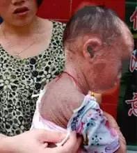 厦门鱼友爆料：“男友跟我承认他是鱼鳞病了！我觉得好恶心啊！”