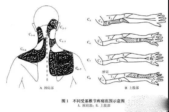 左上臂疼痛预示三种病,左上臂疼痛位置图详解