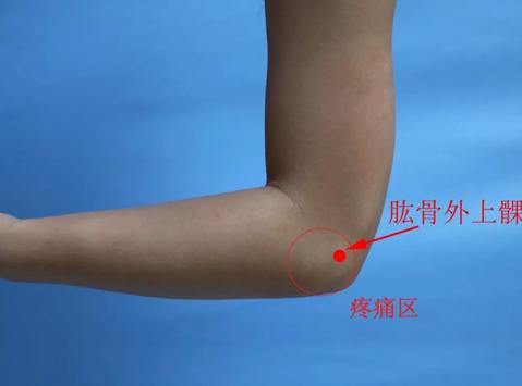 右胳膊上臂疼痛,胳膊游走性疼痛