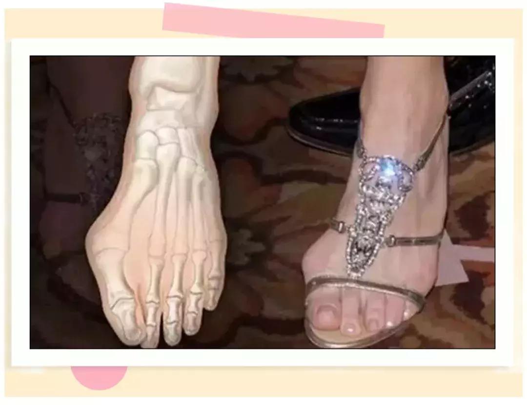 脚短脚宽如何选鞋子,脚小但是脚板宽怎么选高跟鞋