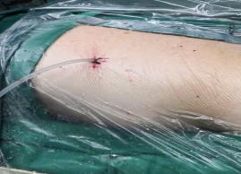 山东治疗泌尿外科比较好的医院,山东大学附属医院泌尿外科专家