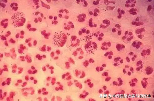 除了艾滋病,这4种常见性传播疾病你了解吗?