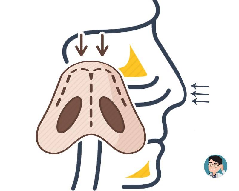 半夜一醒来就咳不停怎么办,夜晚久咳不停怎么办