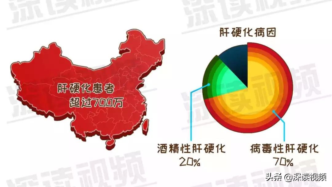 肝硬化70,肝硬化7.75严重吗
