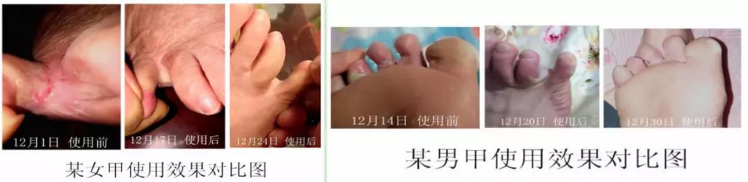 阿迪达斯一双鞋子到底有多少成本,贫穷限制了我的想象一件衣服几万