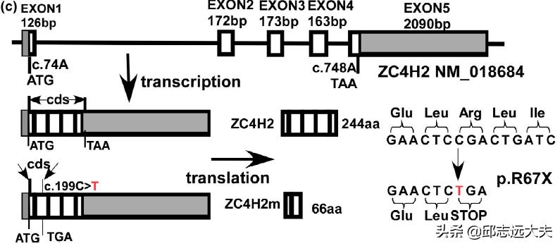 胃肠道间质瘤基因检测野生型,胃肠间质瘤c-kit基因检测是什么