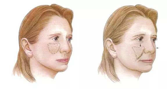 法令纹就是最好的证明,女人上年纪没长法令纹