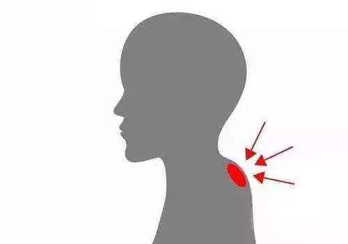 什么是“富贵包”?学会这几招,完美摆平颈后大包!