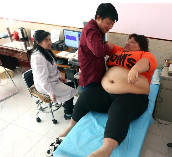 妈妈130斤减肥到100斤的成功案例,女子为了怀孕花27万减肥