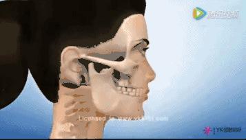 高颧骨脸颊凹妆容,高颧骨有办法改善吗