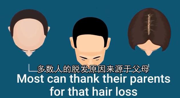 小贝上央视新闻,小贝秃头照