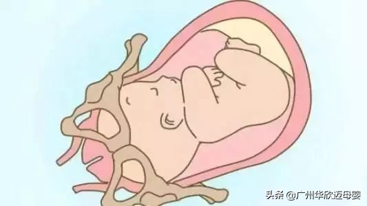 胎儿入盆是什么时候发动,胎儿入盆需要多久完成入盆