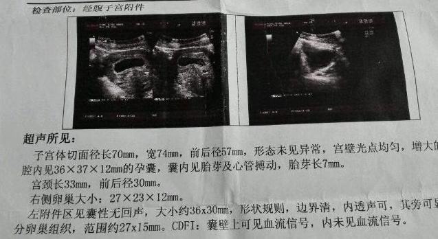 想要小棉袄,想要小棉袄的原因