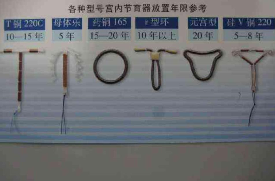 上环后悔了想取环,不想再生了是结扎好还是上环好