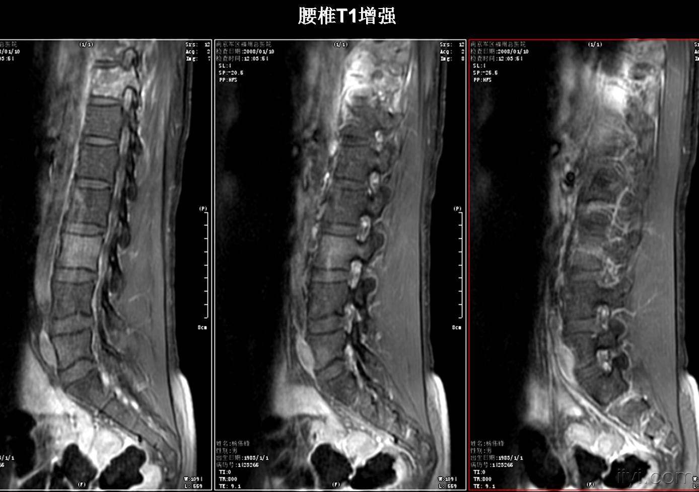 ctmr比较,ct和mri图片对比