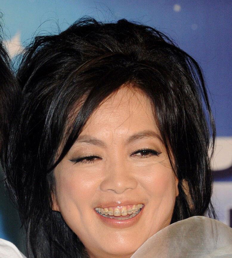 吴宣仪做牙齿前后对比,吴宣仪做整牙