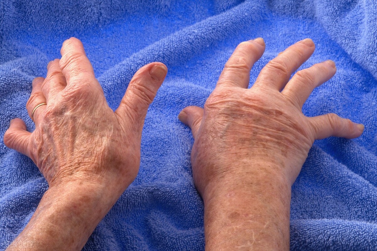 风湿关节痛怎样保暖,风湿关节痛怎么治好得快