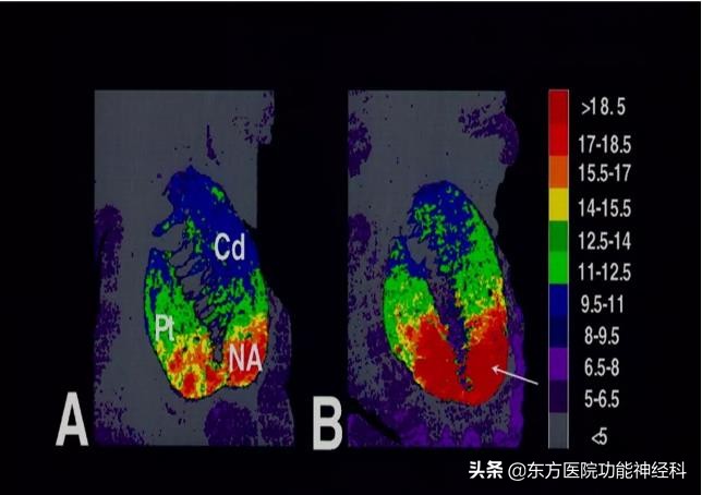 精神病人的前世,精神科药物的前世今生