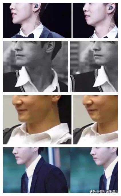 为什么侧颜没有下巴轮廓,侧颜怎么p下巴