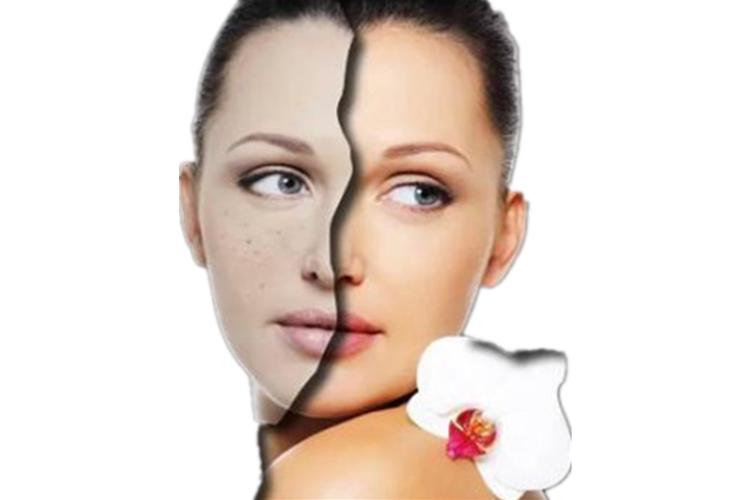 女人脸上有斑吃什么药可以祛斑,脸上长斑吃什么中药调理祛斑