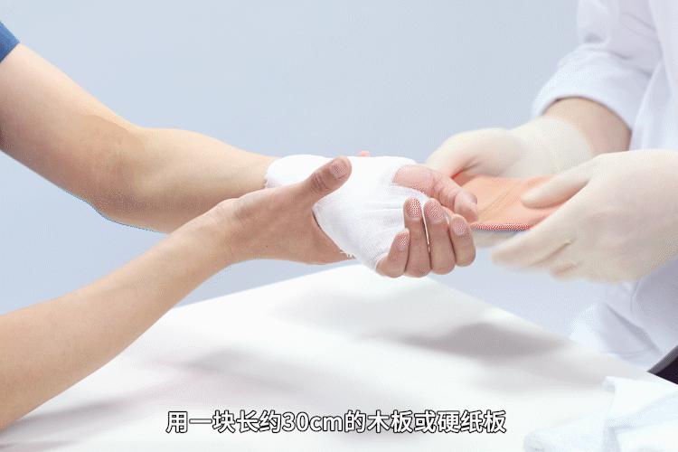 科普生活知识——手腕摔伤处理方法