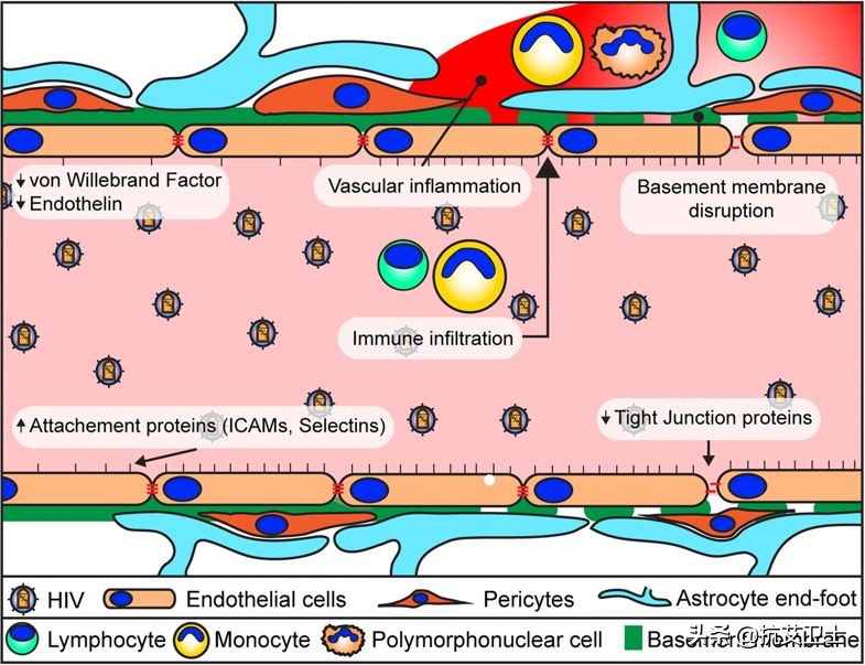 艾滋病与血脑屏障,艾滋病早期会导致血常规哪些异常