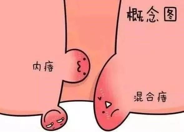 便中带鲜红血是什么病,便中带血怎么调整