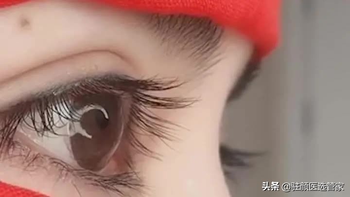 十个关于双眼皮的真相,关于双眼皮有哪些误区