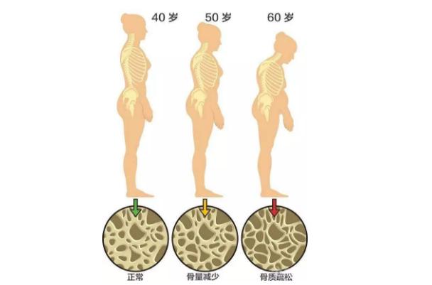 老年人髋部骨折的治疗方法,髋部骨折危害大老年人摔伤要重视