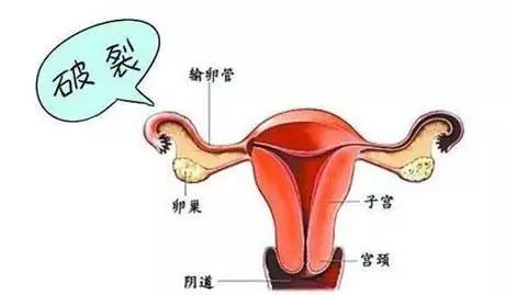 什么症状是停经后阴道流血,停经一年肚子疼流血