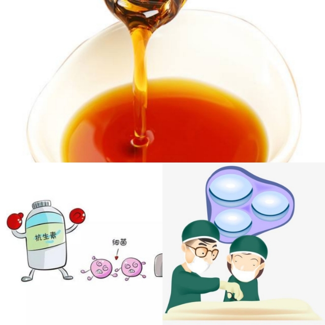 手术后肠子粘连是因为不运动嘛,肠粘连手术后肚子老是阵阵疼