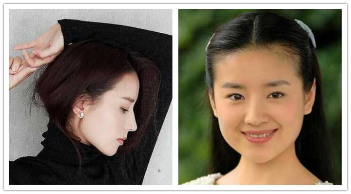 如何改善咬肌鹅蛋脸,咬肌变大脸发腮怎么改善