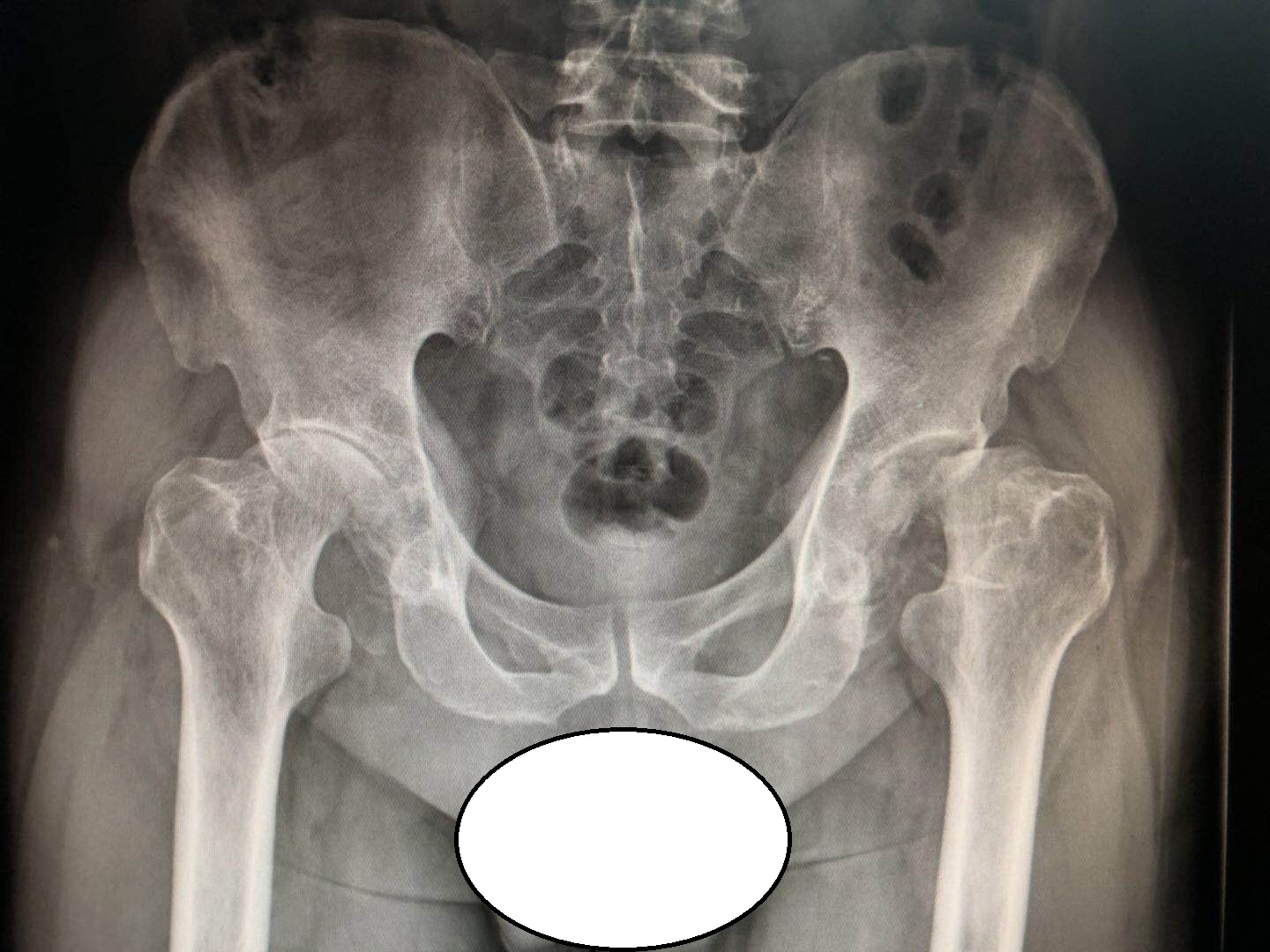 治病只要“头痛医头，脚痛医脚”就可以？这是真的吗？