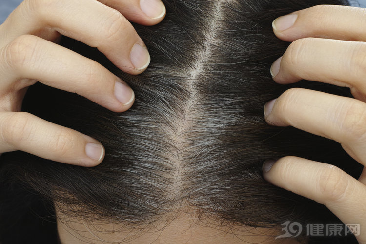 少白头除了染发还有什么办法,拯救白发的最好方法