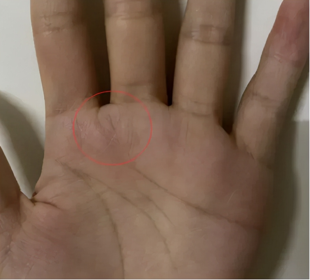 手诊看身体状况准吗,手诊手指看健康