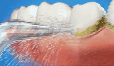 刷牙如何解决口臭,每天坚持两次刷牙多久能解决口臭