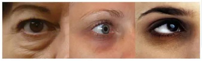 女性黑眼圈好重吃什么可以调理,女性眼圈发青黑眼圈严重吃什么药