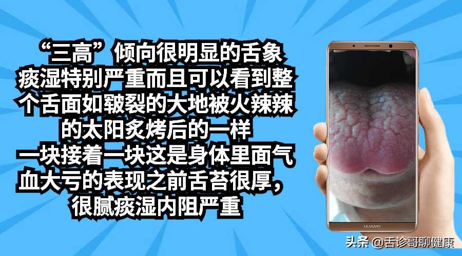 抖音舌诊哥舌象分析与感悟,舌诊歌的分析